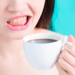 налет на зубах