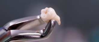 Народные приметы о зубах мудрости