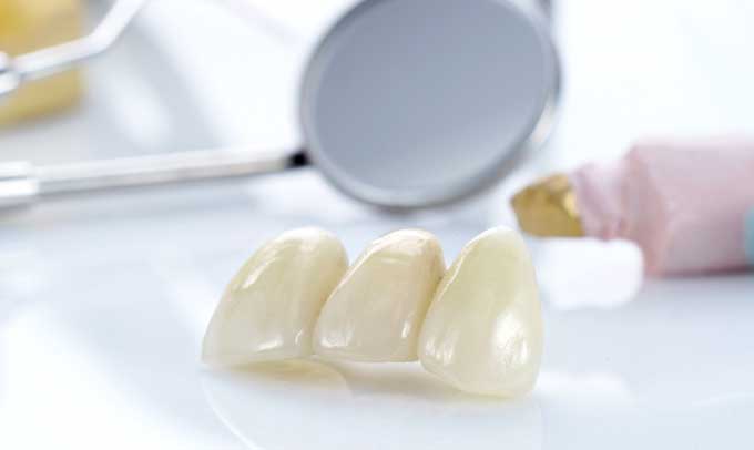 несъемные зубные протезы по новой методике