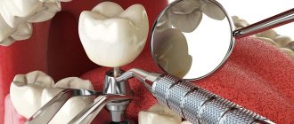 новые технологии имплантации в стоматологии
