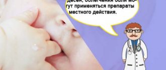 облегчение