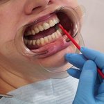 обработка зубов