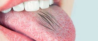 Sensation of hair on tongue