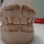 Основы изготовления слепков зубов