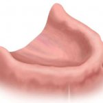 Особенности классификации беззубых челюстей по Оксману