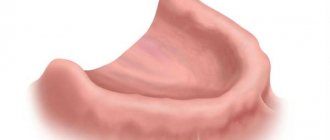 Features of the classification of toothless jaws according to Oksman
