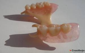 От чего зависит стоимость зубных протезов Акри