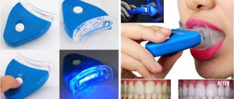 Whitening with White Light