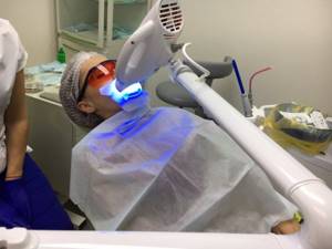 Отбеливание зубов москва beyond oral b vitality sensitive электрическая зубная щетка