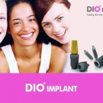 Reviews from experts and patients about Dio implants