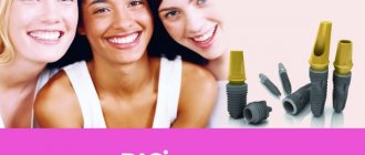 Reviews from experts and patients about Dio implants