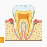 Пародонтоз в картинках