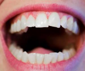 Передние зубы