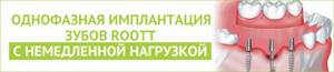 Протезирование по полису. Имплантация зубов по ОМС. Протезирование зубов по полису ОМС бесплатно.