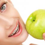 питание при брекетах