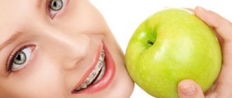 nutrition with braces