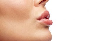 upper lip frenuloplasty