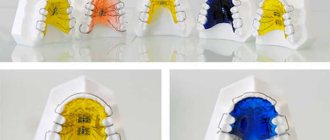 single-jaw dental plates