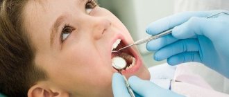 Filling material Estelite for restoration of anterior teeth