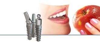 Pros and cons of Impro implants