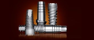 Pros and cons of SGS implants