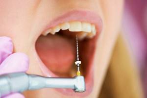 Почему боль в зубе после чистки каналов