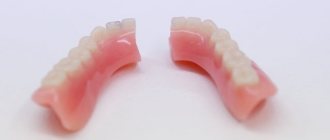 почему ломаются пластиковые зубные протезы