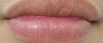 Почему на губах под кожей появляются белые точки, пятна, пупырышки