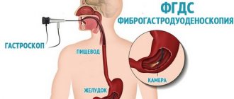 Why does bitterness in the mouth and nausea occur after eating?