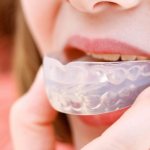 Indications for use of the elastopositioner Corrector