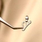 Показания к установке пластиночных имплантатов