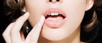 redness in the corners of the lips