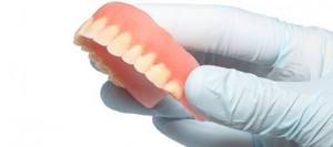 покрывные зубные протезы и их типы