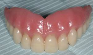 Полные ортопедические зубные протезы