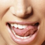 a brown coating appeared on the tongue