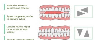 Правила профилактики ночного бруксизма