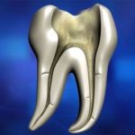 Правила размешивания пасты Proroot mta