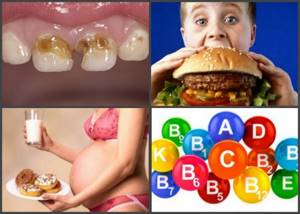 причины крошения зубов у детей
