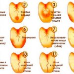 Reasons for the raid