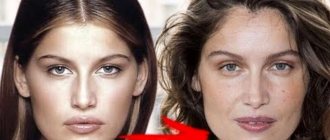 Прикус губы фото