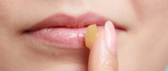 Application of ointments
