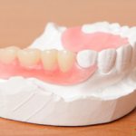 Acri-Free prostheses