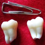 Растет зуб мудрости и болит десна