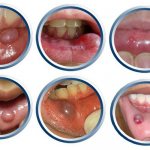 Разнообразие проявлений