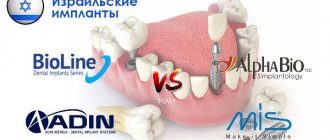 Types of Israeli dental implants