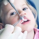 Types of crowns for prosthetics of baby teeth