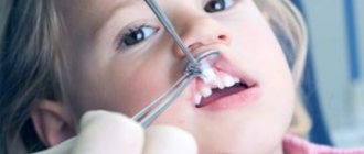 Разновидности коронок для протезирования молочных зубов