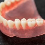 Real service life of dentures with suction cups