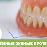 съемные зубные протезы