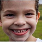 Щели между молочными зубами